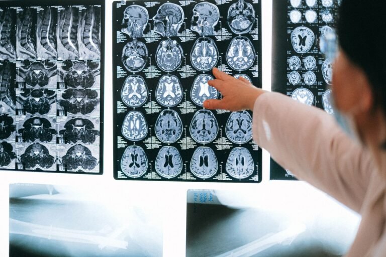 Documenting Neurological Deficits: A Records Checklist for Instructing Solicitors in Personal Injury Claims